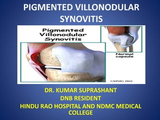 PIGMENTED VILLONODULAR
SYNOVITIS
DR. KUMAR SUPRASHANT
DNB RESIDENT
HINDU RAO HOSPITAL AND NDMC MEDICAL
COLLEGE
 