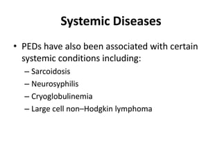 Systemic Diseases
• PEDs have also been associated with certain
systemic conditions including:
– Sarcoidosis
– Neurosyphilis
– Cryoglobulinemia
– Large cell non–Hodgkin lymphoma
 