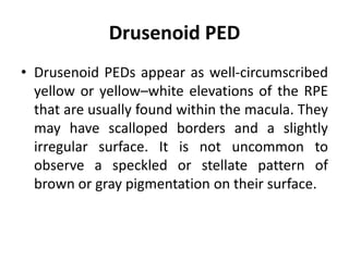 Drusenoid PED
• Drusenoid PEDs appear as well-circumscribed
yellow or yellow–white elevations of the RPE
that are usually found within the macula. They
may have scalloped borders and a slightly
irregular surface. It is not uncommon to
observe a speckled or stellate pattern of
brown or gray pigmentation on their surface.
 