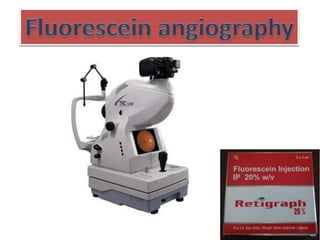 Fluorescein angiography
 