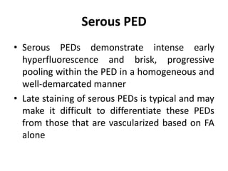 Serous PED
• Serous PEDs demonstrate intense early
hyperfluorescence and brisk, progressive
pooling within the PED in a homogeneous and
well-demarcated manner
• Late staining of serous PEDs is typical and may
make it difficult to differentiate these PEDs
from those that are vascularized based on FA
alone
 