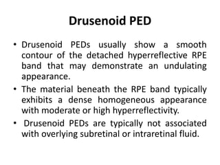 Drusenoid PED
• Drusenoid PEDs usually show a smooth
contour of the detached hyperreflective RPE
band that may demonstrate an undulating
appearance.
• The material beneath the RPE band typically
exhibits a dense homogeneous appearance
with moderate or high hyperreflectivity.
• Drusenoid PEDs are typically not associated
with overlying subretinal or intraretinal fluid.
 