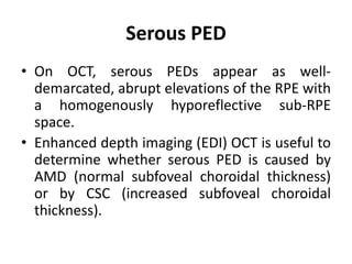 Serous PED
• On OCT, serous PEDs appear as well-
demarcated, abrupt elevations of the RPE with
a homogenously hyporeflective sub-RPE
space.
• Enhanced depth imaging (EDI) OCT is useful to
determine whether serous PED is caused by
AMD (normal subfoveal choroidal thickness)
or by CSC (increased subfoveal choroidal
thickness).
 