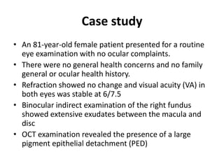 Case study
• An 81-year-old female patient presented for a routine
eye examination with no ocular complaints.
• There were no general health concerns and no family
general or ocular health history.
• Refraction showed no change and visual acuity (VA) in
both eyes was stable at 6/7.5
• Binocular indirect examination of the right fundus
showed extensive exudates between the macula and
disc
• OCT examination revealed the presence of a large
pigment epithelial detachment (PED)
 