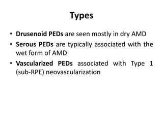 Types
• Drusenoid PEDs are seen mostly in dry AMD
• Serous PEDs are typically associated with the
wet form of AMD
• Vascularized PEDs associated with Type 1
(sub-RPE) neovascularization
 