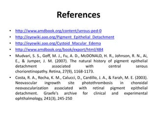 References
• http://www.amdbook.org/content/serous-ped-0
• http://eyewiki.aao.org/Pigment_Epithelial_Detachment
• http://eyewiki.aao.org/Cystoid_Macular_Edema
• http://www.amdbook.org/book/export/html/484
• Mudvari, S. S., Goff, M. J., Fu, A. D., McDONALD, H. R., Johnson, R. N., Ai,
E., & Jumper, J. M. (2007). The natural history of pigment epithelial
detachment associated with central serous
chorioretinopathy. Retina, 27(9), 1168-1173.
• Costa, R. A., Rocha, K. M., Calucci, D., Cardillo, J. A., & Farah, M. E. (2003).
Neovascular ingrowth site photothrombosis in choroidal
neovascularization associated with retinal pigment epithelial
detachment. Graefe's archive for clinical and experimental
ophthalmology, 241(3), 245-250
 