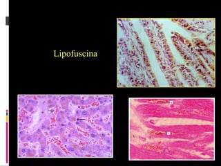Lipofuscina
 