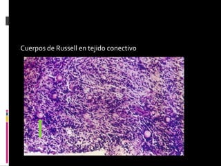 Cuerpos de Russell en tejido conectivo
 