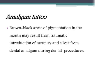 Amalgam tattoo
• Brown-black areas of pigmentation in the
mouth may result from traumatic
introduction of mercury and silver from
dental amalgam during dental procedures.
 