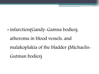 • infarction(Gandy-Gamna bodies),
atheroma in blood vessels, and
malakoplakia of the bladder (Michaelis-
Gutman bodies)
 
