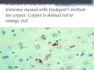 A section of fetal liver of the third
trimester stained with Lindquist’s method
for copper. Copper is stained red to
orange-red
 