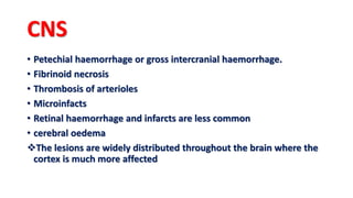 CNS
• Petechial haemorrhage or gross intercranial haemorrhage.
• Fibrinoid necrosis
• Thrombosis of arterioles
• Microinfacts
• Retinal haemorrhage and infarcts are less common
• cerebral oedema
The lesions are widely distributed throughout the brain where the
cortex is much more affected
 
