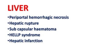 LIVER
•Periportal hemorrhagic necrosis
•Hepatic rupture
•Sub capsular haematoma
•HELLP syndrome
•Hepatic infarction
 