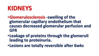 KIDNEYS
•Glomerulosclerosis -swelling of the
glomerular capillary endothelium that
causes decreased glomerular perfusion and
GFR
•Leakage of proteins through the glomeruli
leading to proteinuria.
•Lesions are totally reversible after 6wks
 