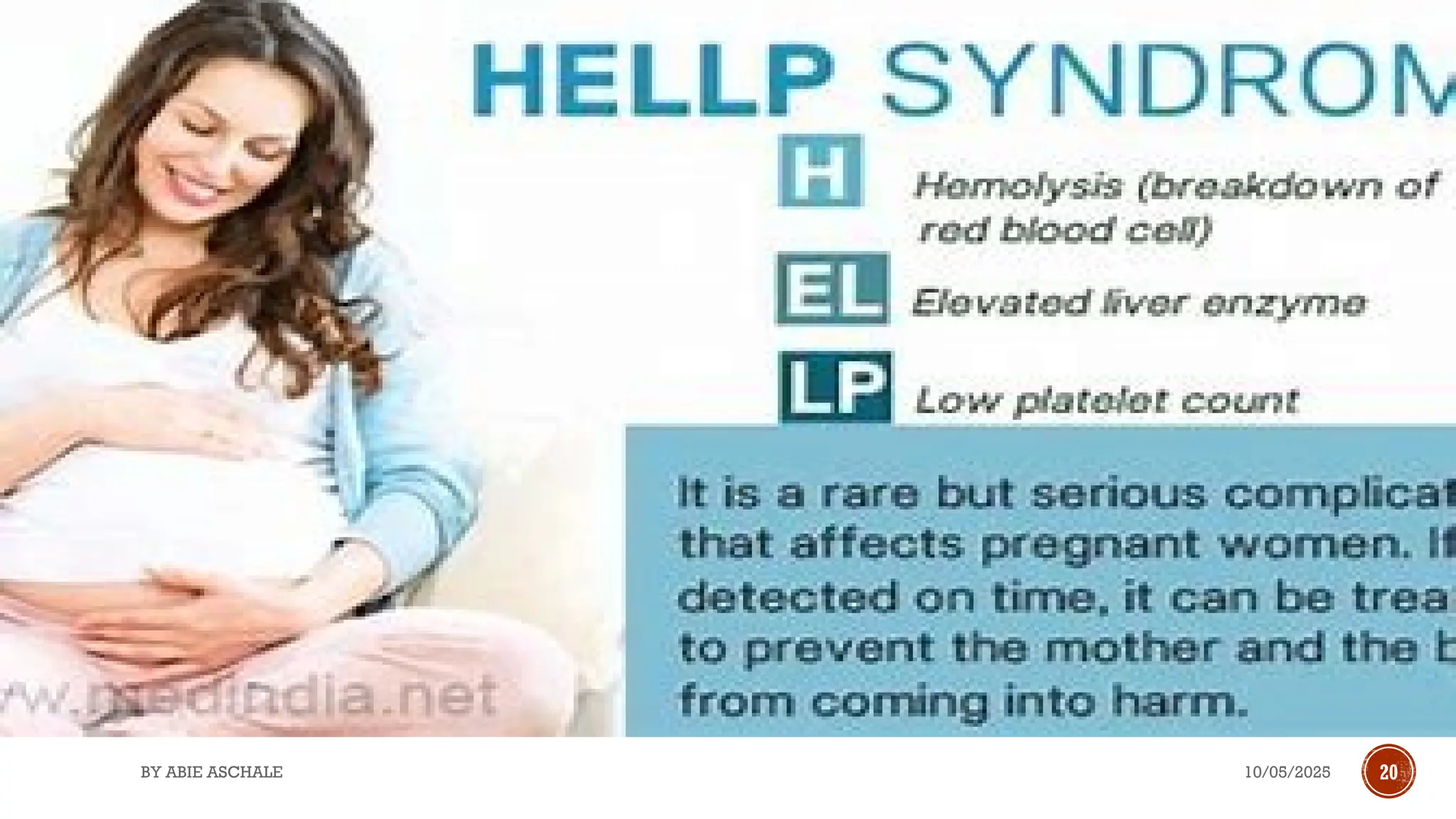 10/05/2025
BY ABIE ASCHALE 20
 