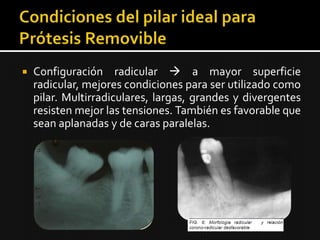  Configuración radicular  a mayor superficie
radicular, mejores condiciones para ser utilizado como
pilar. Multirradiculares, largas, grandes y divergentes
resisten mejor las tensiones. También es favorable que
sean aplanadas y de caras paralelas.
 