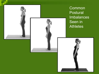 Common Postural Imbalances Seen in Athletes 