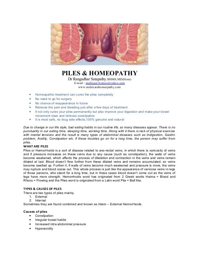 Homeopathy treatment for Piles
