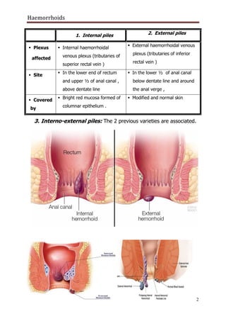 Piles Hemorrhoid causes presentation.pdf