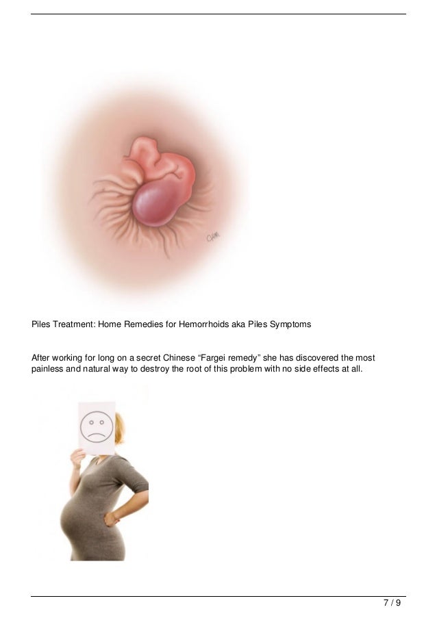 Piles Treatment Natural Way Piles Treatment Natural Way