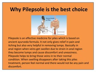 Why Pilepsole is the best choice
Pilepsole is an effective medicine for piles which is based on
ancient ayurveda formula. It not only gives relief in pain and
itching but also very helpful in removing lumps. Basically in
anal region when veins get swollen due to strain in anal region
they become lumps and cause discomfort and uneasiness.
Pilepsole helps to bring those veins in to their normal
condition. When swelling disappears after taking this piles
treatment, person feel normal and there would not be any pain and
discomfort.
 
