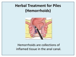 Herbal Treatment for Piles
(Hemorrhoids)
Hemorrhoids are collections of
inflamed tissue in the anal canal.
 