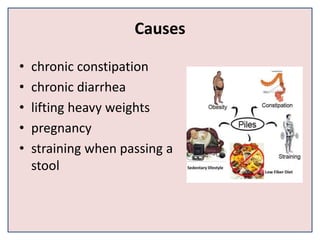 Causes
• chronic constipation
• chronic diarrhea
• lifting heavy weights
• pregnancy
• straining when passing a
stool
 