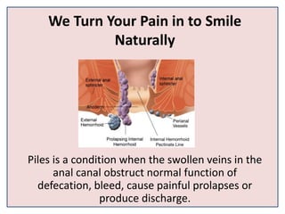 We Turn Your Pain in to Smile
Naturally
Piles is a condition when the swollen veins in the
anal canal obstruct normal function of
defecation, bleed, cause painful prolapses or
produce discharge.
 