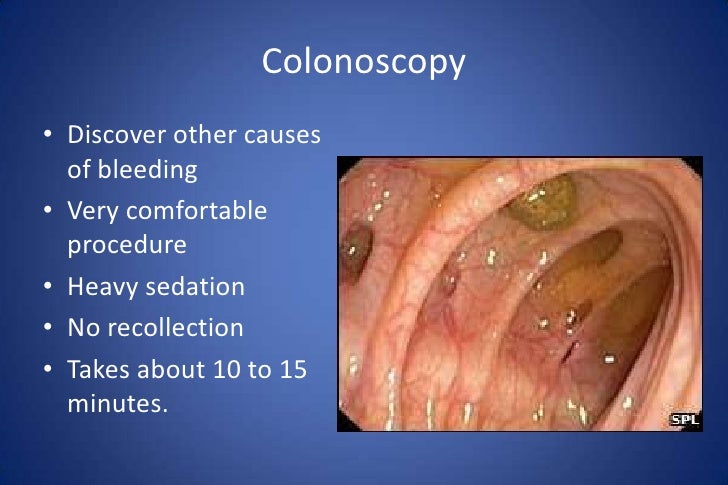 Anal Rectal Cancer Symptoms