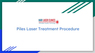 Piles Laser Treatment Procedure
 