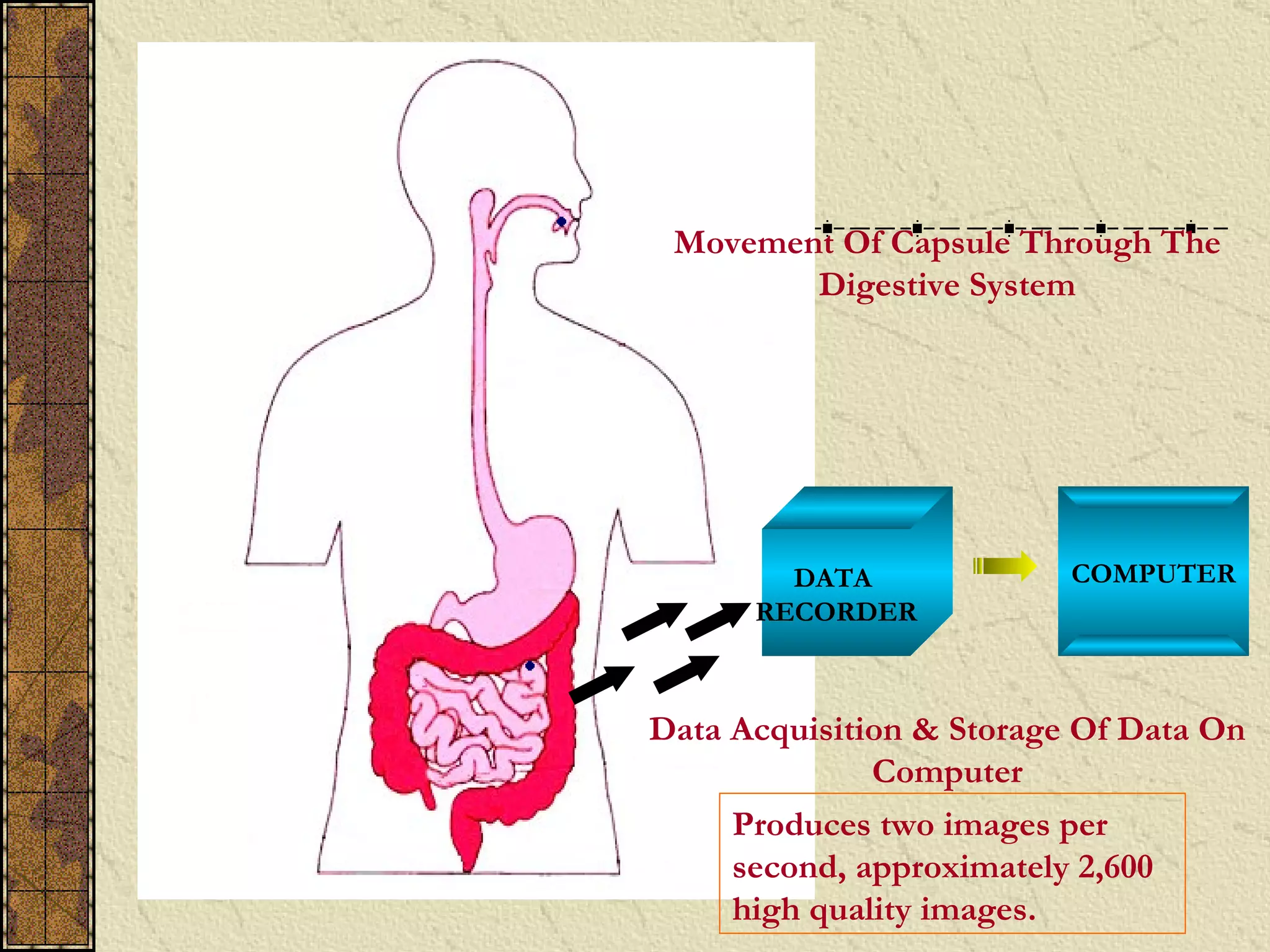 Movement Of Capsule Through The
        Digestive System




        DATA              COMPUTER
      RECORDER



Data Acquisition & Storage Of Data On
              Computer
     Produces two images per
     second, approximately 2,600
     high quality images.
 