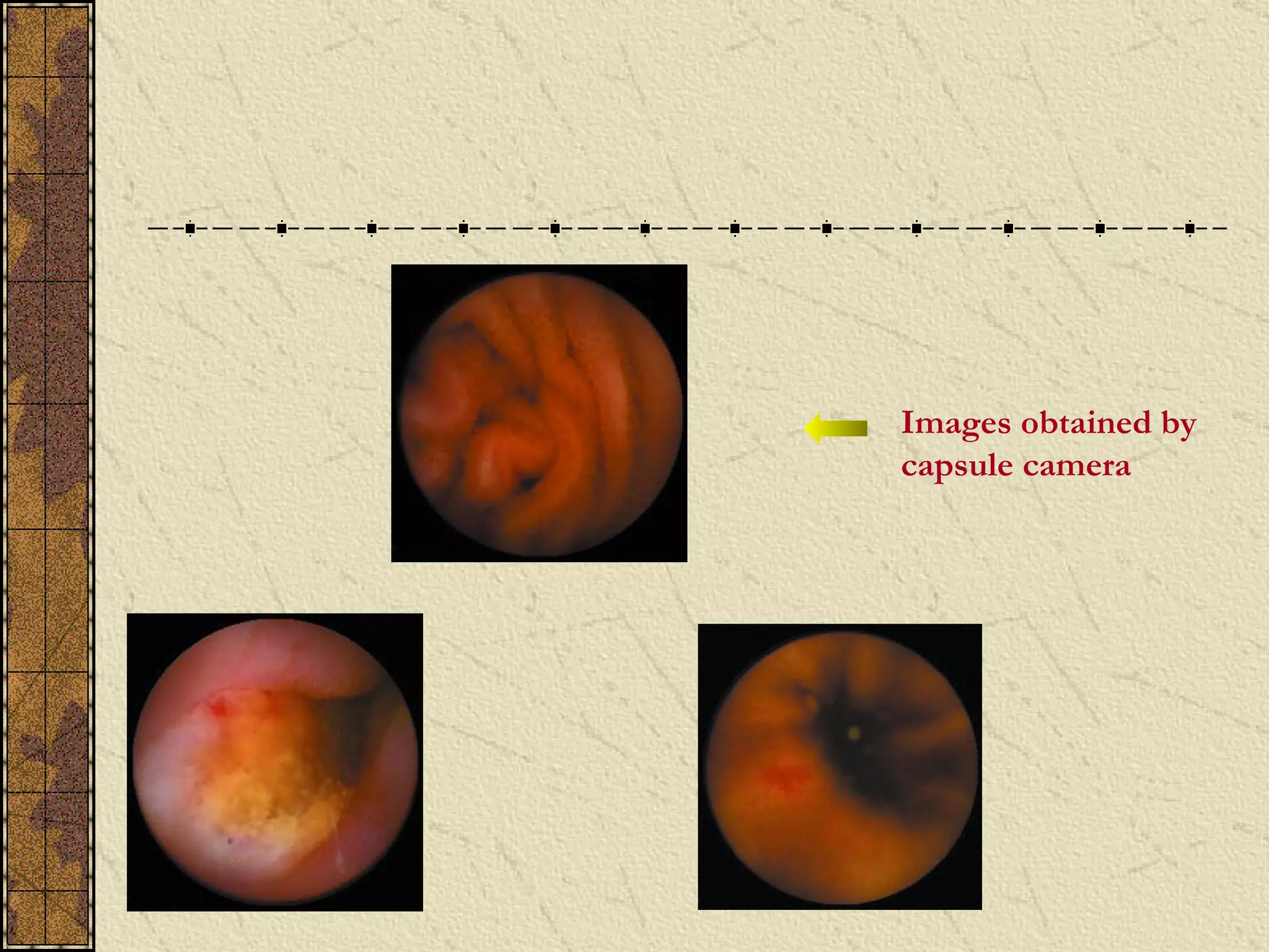 Images obtained by
capsule camera
 