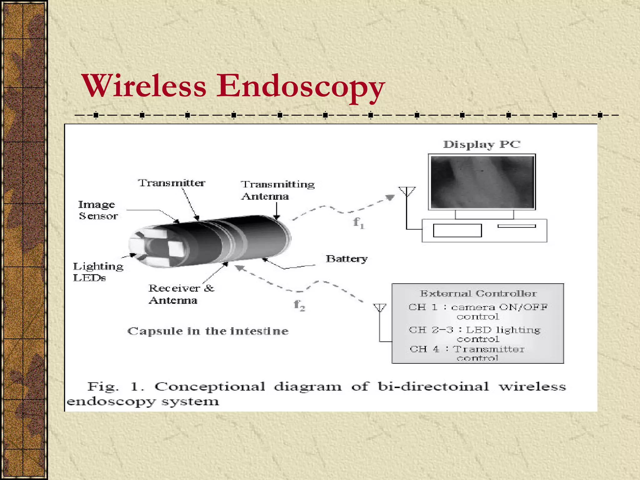 Wireless Endoscopy
 