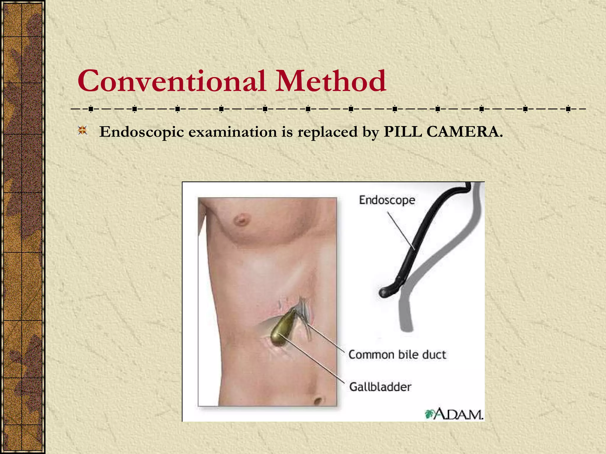 Conventional Method
 Endoscopic examination is replaced by PILL CAMERA.
 