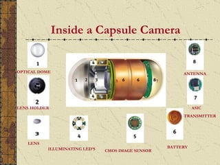 Inside a Capsule Camera


OPTICAL DOME                                                 ANTENNA
                                    5               7




LENS HOLDER                                                       ASIC
                                                             TRANSMITTER




   LENS
           ILLUMINATING LED’S                           BATTERY
                                CMOS IMAGE SENSOR
 