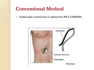 pill-camera-ppt.pptx