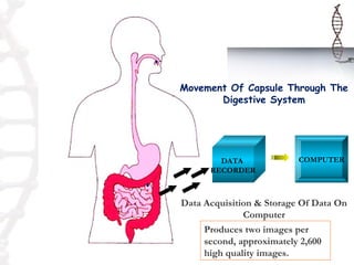 Movement Of Capsule Through The
       Digestive System




        DATA              COMPUTER
      RECORDER



Data Acquisition & Storage Of Data On
              Computer
     Produces two images per
     second, approximately 2,600
     high quality images.
 