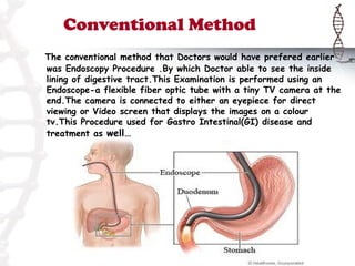 Conventional Method
The conventional method that Doctors would have prefered earlier
was Endoscopy Procedure .By which Doctor able to see the inside
lining of digestive tract.This Examination is performed using an
Endoscope-a flexible fiber optic tube with a tiny TV camera at the
end.The camera is connected to either an eyepiece for direct
viewing or Video screen that displays the images on a colour
tv.This Procedure used for Gastro Intestinal(GI) disease and
treatment as well…
 