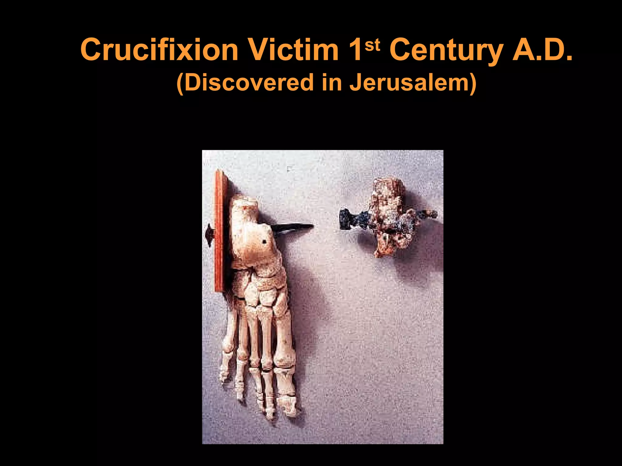 Crucifixion Victim 1 st  Century A.D.  (Discovered in Jerusalem) 