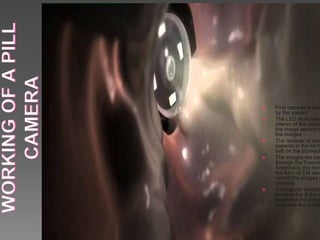  First capsule is swa
by the patient
 The LED illuminate
interior of the stoma
the image sensor re
the images
 The reciever is wor
patients in the form
belt on the stomach
 The images are pas
through the Transm
Antenna to the reci
the form of EM wav
record the images i
memory.
 A computer worksta
process the & the d
examines the imag
diagnose the proble
 