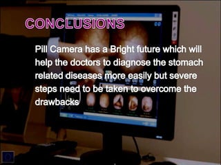 Pill camera by mohammad aamir arafat.pptx