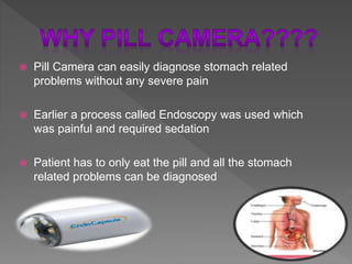  Pill Camera can easily diagnose stomach related
problems without any severe pain
 Earlier a process called Endoscopy was used which
was painful and required sedation
 Patient has to only eat the pill and all the stomach
related problems can be diagnosed
 