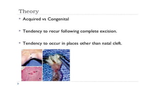 Pilonidal Sinus Racgp Pilonidal sinus disease | PPTX