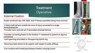 Diagnosis and Management of Tibial Plafond / Pilon Fracture.pptx