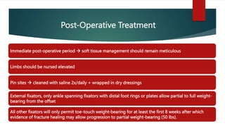 Diagnosis and Management of Tibial Plafond / Pilon Fracture.pptx