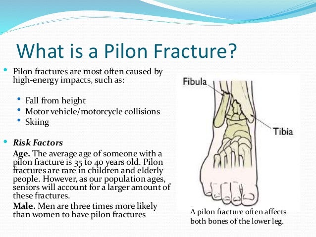 Pilon Fractures