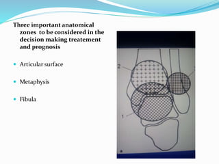 Three important anatomical
zones to be considered in the
decision making treatement
and prognosis
 Articular surface
 Metaphysis
 Fibula
 