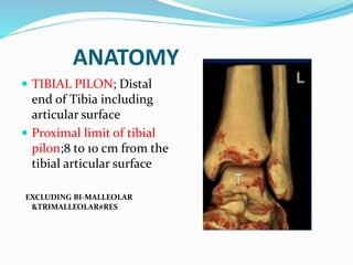 ANATOMY
 TIBIAL PILON; Distal
end of Tibia including
articular surface
 Proximal limit of tibial
pilon;8 to 10 cm from the
tibial articular surface
EXCLUDING BI-MALLEOLAR
&TRIMALLEOLAR#RES
 
