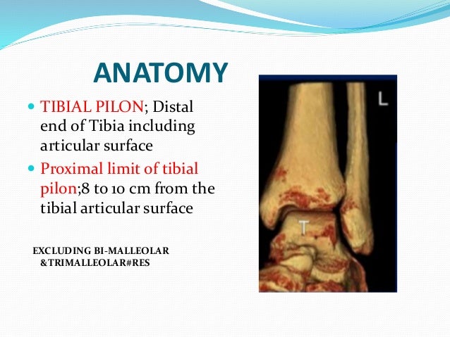 Pilon Fractures Pilon Fractures