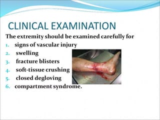 Pilon fractures | PPTX